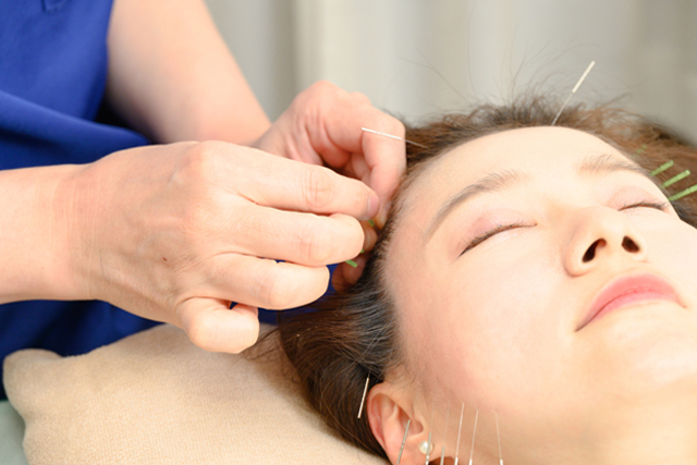 微弱電流美容鍼