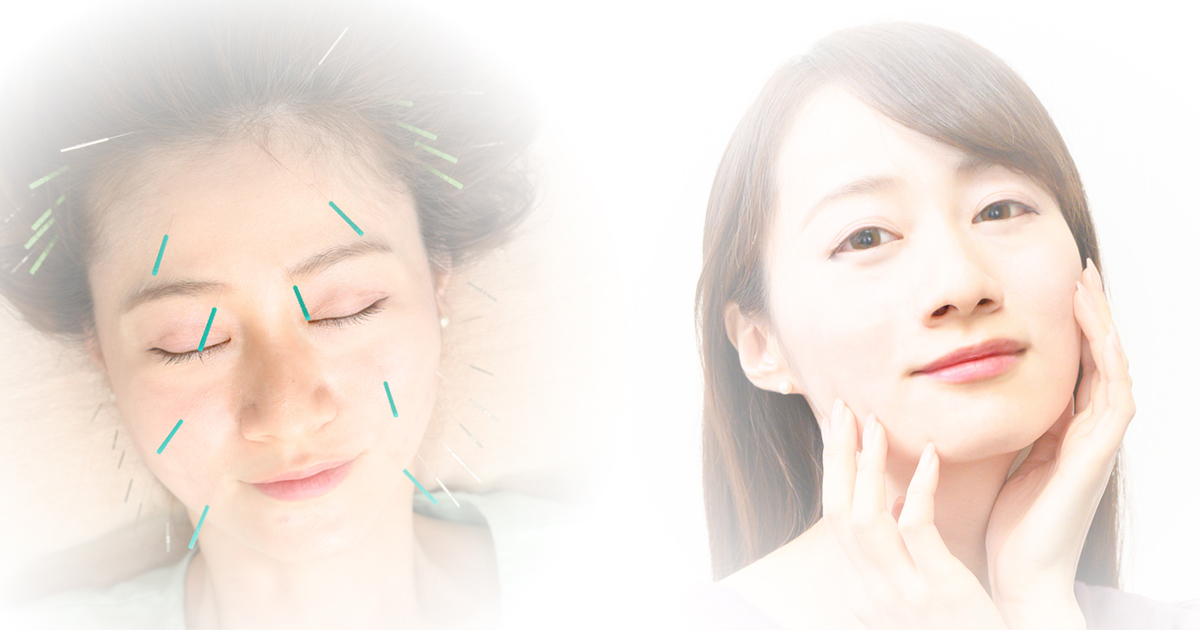 美容鍼の効果イメージ