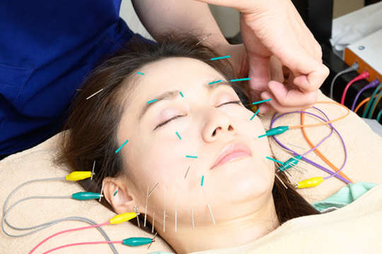 美容鍼プレミアム施術