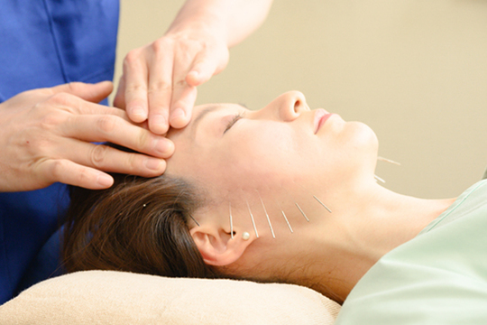 美容鍼施術