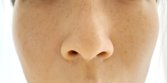 たるみイラスト