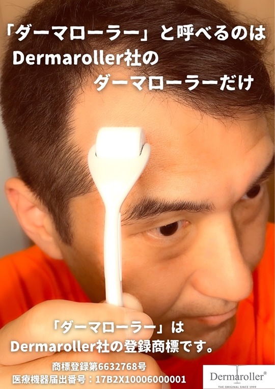 ダーマローラー育毛