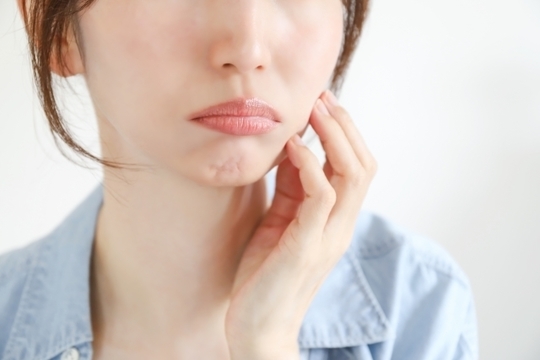 たるみイラスト